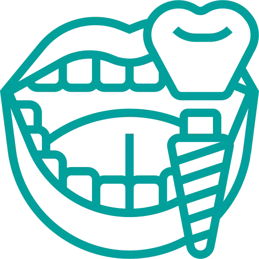 Dental implant | Defex Oral Surgery