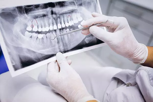 Dentist reviewing a dental x-ray